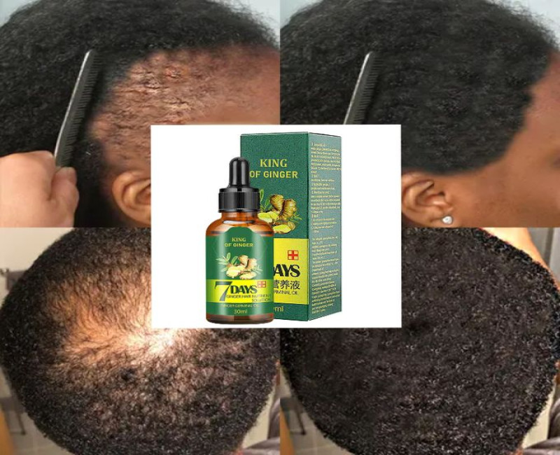 Beard Oil For Beard Growth - 30ml